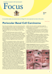 Focus Winter 2011 – Periocular Basal Cell Carcinoma