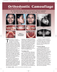 Orthodontic Camouflage of a Class