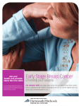 Early Stage Breast Cancer: Choosing your Surgery