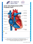 Aortic Valve Replacement - Children`s Heart Clinic