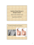 Sentinel Node Biopsy in Breast Cancer