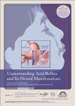 Understanding Acid Reflux and It`s Dental Manifestations