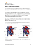 Atrial Septal Defect