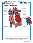 Rastelli Procedure - Children`s Heart Clinic