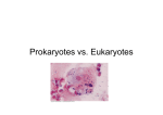 Prokaryotes vs. Eukaryotes