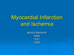 Myocardial Infacrction and ischeamia