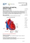ventricular septal defect (vsd)