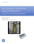 Transcatheter pulmonary valve implantation clinical