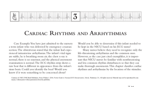 CARDiAC RHYTHMS AND ARRHYTHMiAS