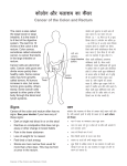 Cancer of the Colon and Rectum - Hindi