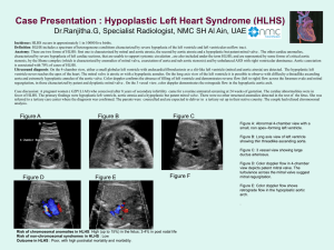 A case of hypoplastic left heart syndrome