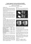 Parallel Imaging for Continuously Moving Table MRI Using Moving