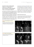 Important Echocardiographic Features of Takotsubo or Stress