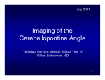 Imaging of the Cerebellopontine Angle