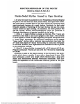 Pseudo-Nodal Rhythm Caused by Cigar Smoking