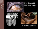 River Blindness (Onchocerciasis )