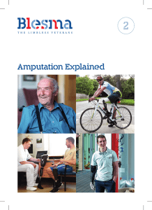 Amputation Explained