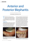 Anterior and Posterior Blepharitis