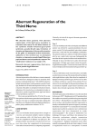 Aberrant Regeneration of the Third Nerve