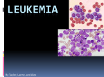 Leukemia - Aurora City Schools