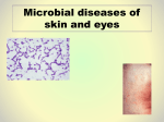 Microbial Diseases Of Skin And eyes - Wikispaces