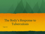 Topic 6.4 Tuberculosis Powerpoint