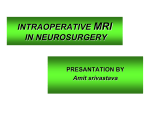 intraoperative mri in neurosurgery