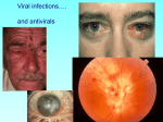 Herpes and Other Viral Diseases of the Eye