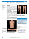 Amoxicillin-associated rash in glandular fever