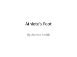 Athlete`s Foot