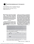 Atrial Arrhythmias with Low Amplitude P waves