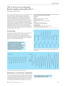 ABC of clinical electrocardiography Broad complex tachycardia—Part I