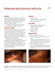 Meibomian Gland Dysfunction and Dry Eye