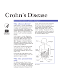 Crohn`s Disease
