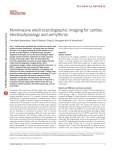 Noninvasive electrocardiographic imaging for cardiac