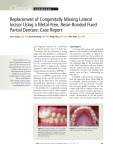 Clinical Showcase - Replacement of Congenitally Missing Lateral