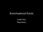 Bronchopleural fistula
