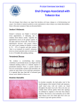 Tobacco Oral Changes