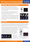 PET Tracers in Prostate Cancer