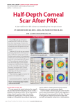 Half-Depth Corneal Scar After PRK