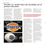 Flexible eye model takes the hardship out of patient