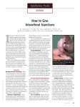 How to Give Intravitreal Injections