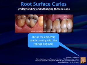 Root Surface Caries - Wellington Branch of the NZDA