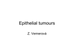 Epithelial tumours