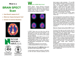 BRAIN SPECT Scan - Nuclear Medicine of Naples