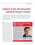 Treatment of skin rash and pruritus induced by biological therapies