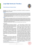Large Right Ventricular Thrombus