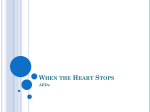 When the Heart Stops