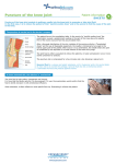 Puncture of the knee joint