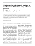 Mini-implant-borne Pendulum B appliance for maxillary molar